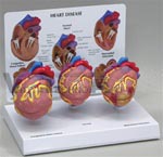 Mini Heart Set Models